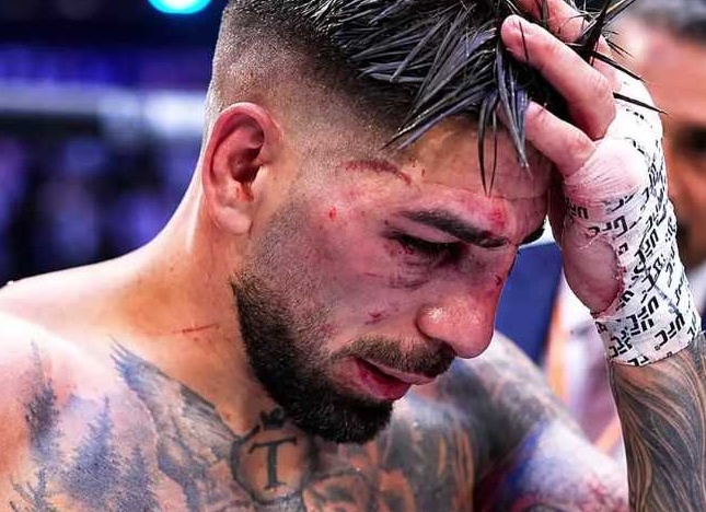 🥊 Топурия избежал тяжёлой травмы